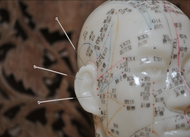 Acupunctuur Praktijk Yingwu